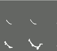 Eclage Perimeter